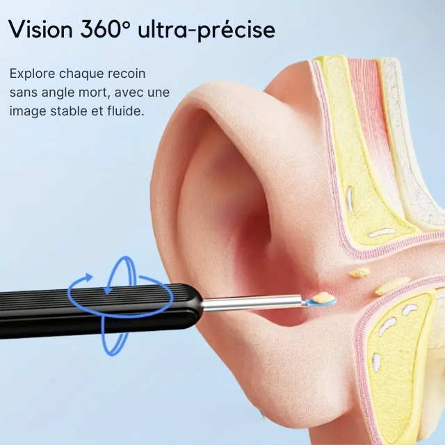 Kit de nettoyage pour oreilles
